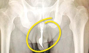 Şi a băgat furculiţa n penis  pentru un orgasm mai intens jpeg