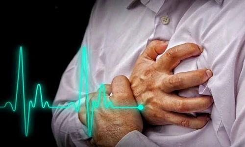 atac de cord simptome jpeg