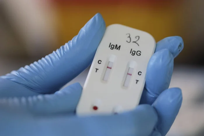 
    În România, testele rapide anti Covid pot fi cumpărate de oricine din farmacii  