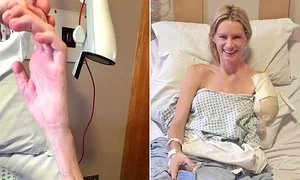 Olivia Jackson a pierdut mâna stângă din cauza accidentului petrecut la filmări jpeg