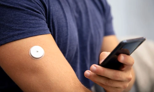 monitorizare glicemie jpg