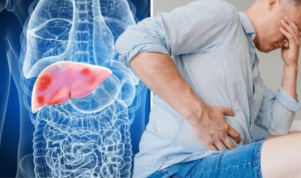  Adevărul Live de la 13.00: Este transplantul hepatic o metodă de tratament accesibilă în România?