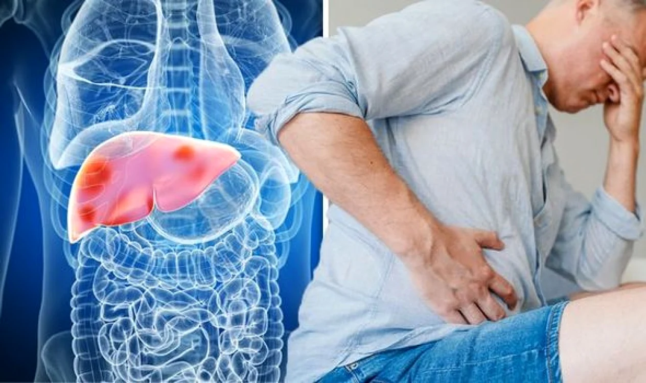 Mai mult de 1 milion de oameni mor anual din cauza hepatitei