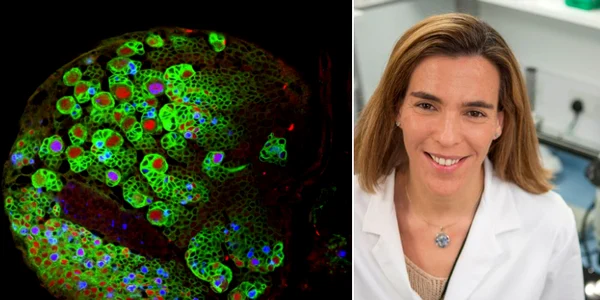 Musculita fructelor, utilă în cercetarile privind tumorile cerebrale foto Brain Tumor Research png