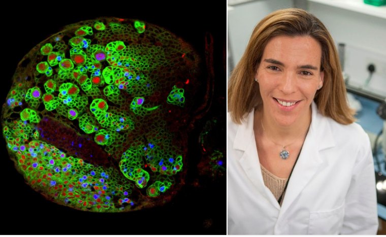 Musculiţele de fructe ar putea contribui la oprirea dezvoltării tumorilor cerebrale