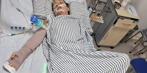 Nora Țichindeleanu doctorița care a fost victima unui accident în Indonezia pe patul de spital FOTO  Gofundme com