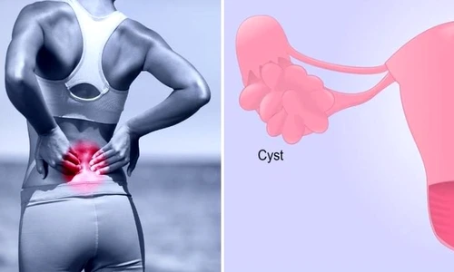 1 81293 original jpg jpeg