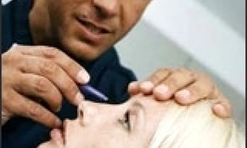 652x450 rinoplastie jpeg