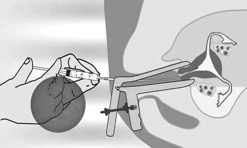 inseminarwe9880989 jpeg