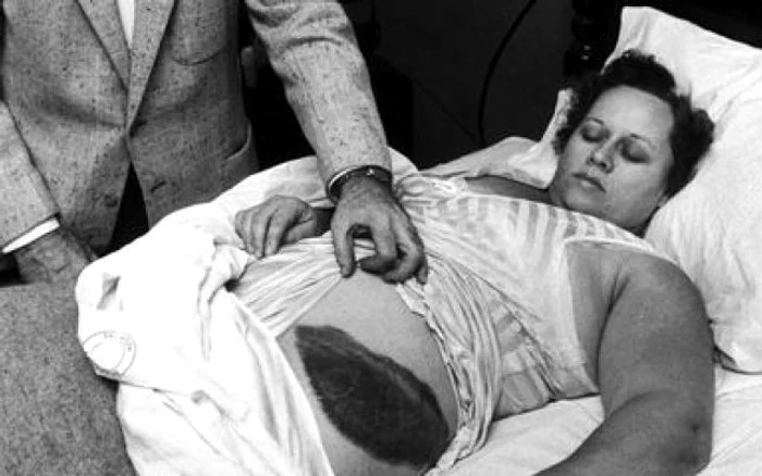 Ann Hodges, americanca lovită de meteorit în 1954