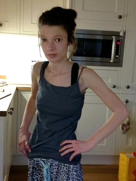 Pastilele de slăbit au afectat grav sănătatea adolescentei