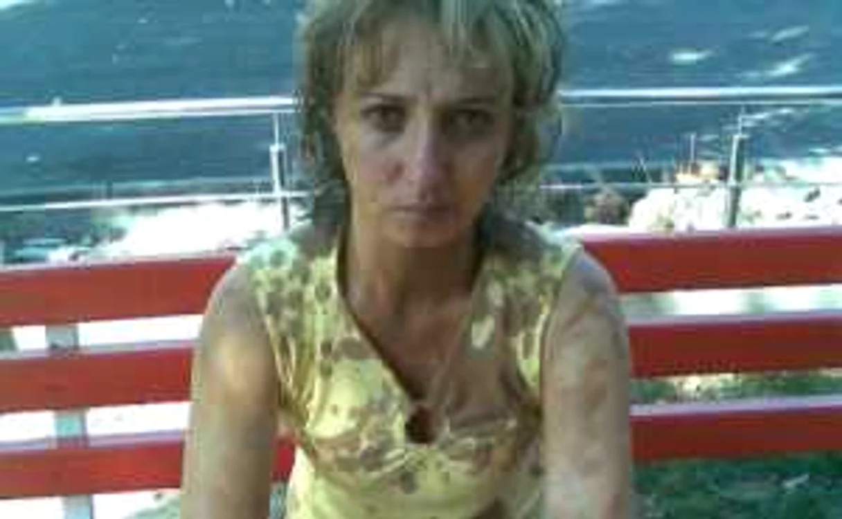 Mihaela Pavel la scurt timp după ce soţul ei a încercat să-i dea foc. Se văd arsurile şi benzina pe haine. 