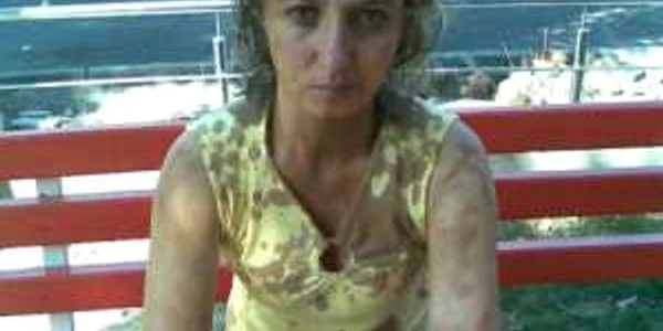 Mihaela Pavel la scurt timp după ce soţul ei a încercat să-i dea foc. Se văd arsurile şi benzina pe haine. 