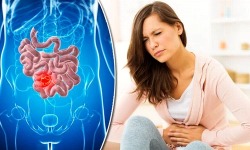 1 72454 original jpg jpeg