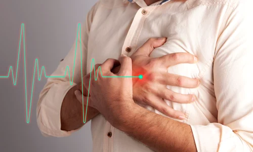 insuficienta cardiaca jpg