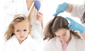 12 sanatate paduchi jpeg