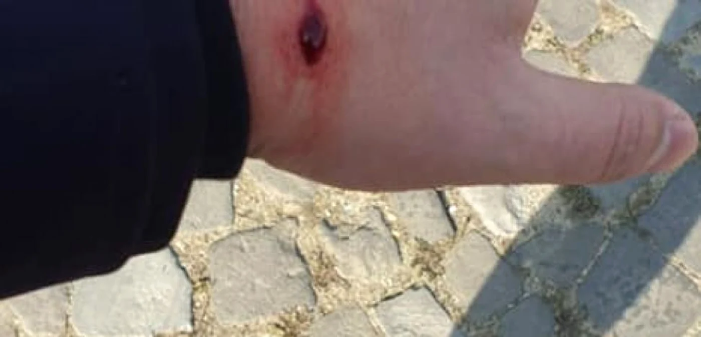 Poliţistul craiovean a fost rânit în timp ce încerca să imobilizeze un bărbat care avea asupra sa un cuţit FOTO Facebook / Sindicatul Poliţiştilor Dolj