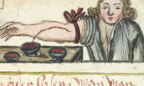 Lipitori pentru infecții, mercur pentru sifilis: leacurile înaintea antibioticelor jpeg