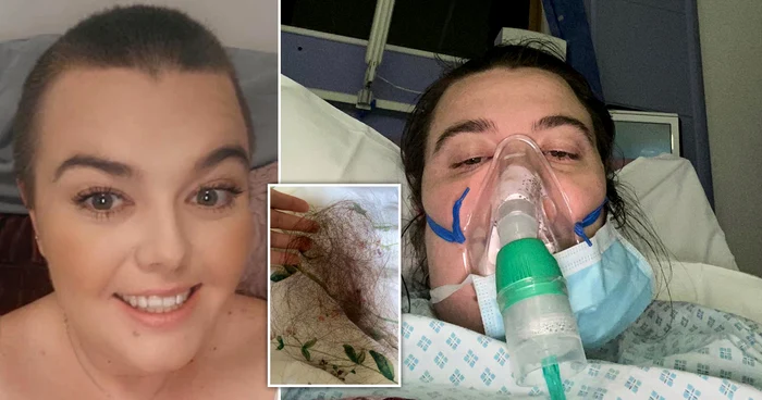 Britanica Grace Dudley a rămas fără păr de la coronavirus