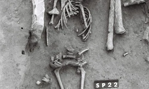 A fost descoperit cel mai vechi caz de Sindromul Down jpeg