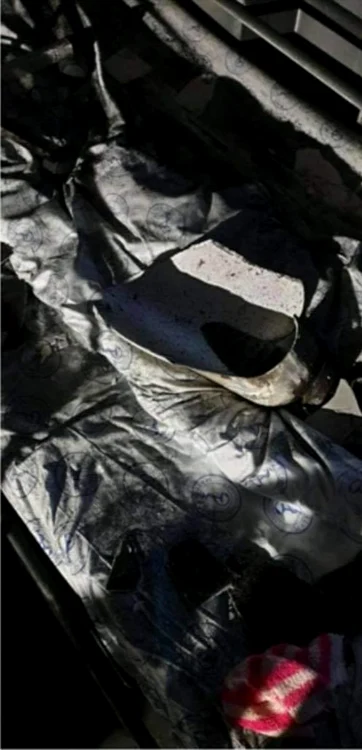 Interiorul spitalului în urma incendiului