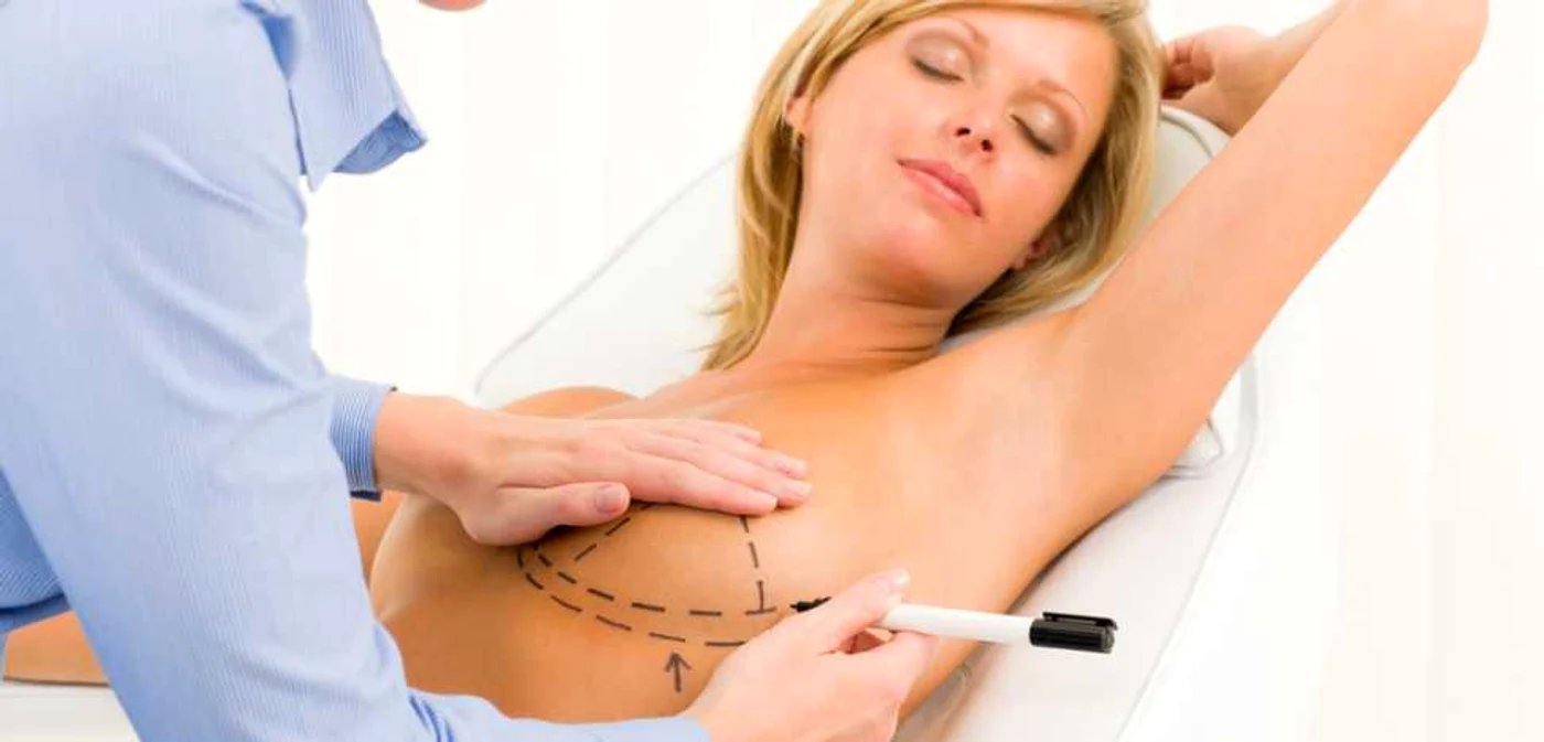 Operaţiile estetice au înregistrat un profit în 2012 FOTO Shutterstock