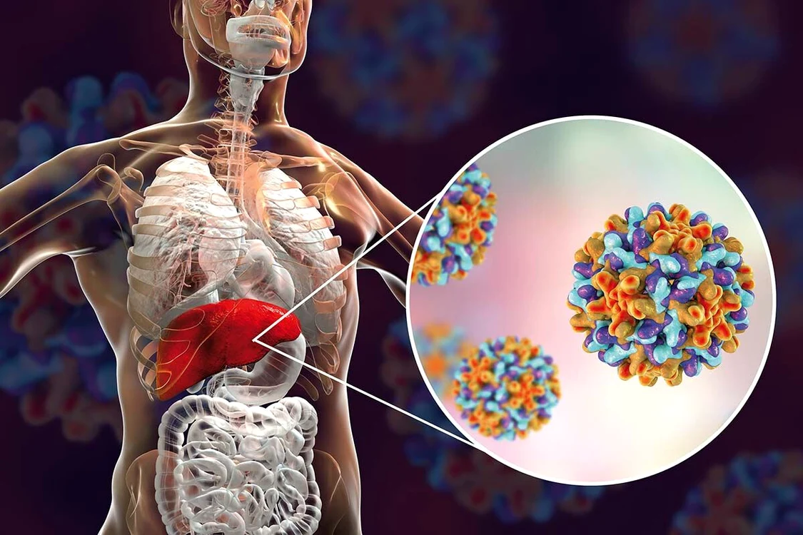 Hepatita E este una dintre tipurile de hepatită rar întâlnită  Sursa foto: Shutterstock
