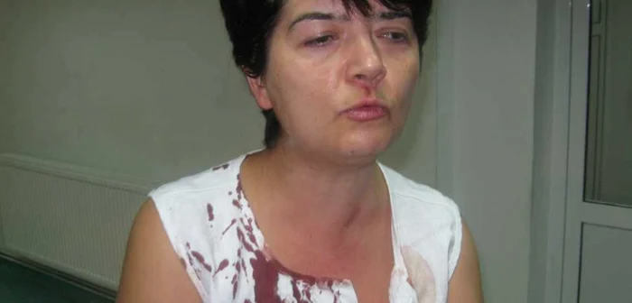 Carmen Obârşanu a fost bătută în centrul Timişoarei de clanul Cârpaci
