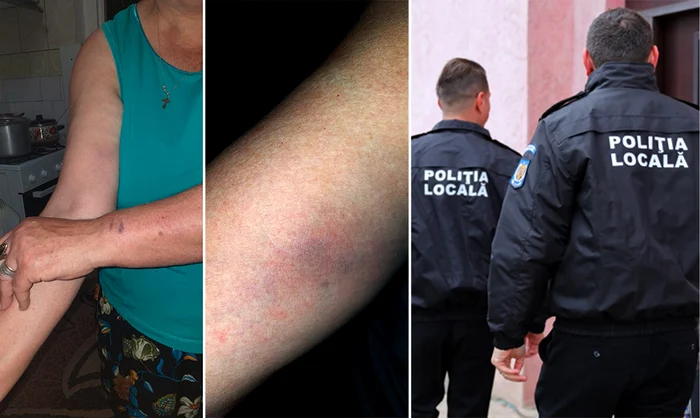 O parte din vânătăile cu care s-au ales cei doi bătrâni FOTO colaj Facebook/Valentin Damian