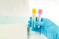 test imunologic fecal jpg