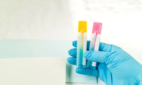 test imunologic fecal jpg