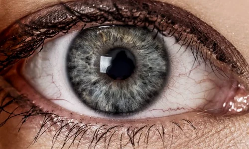 1 iridologie jpg jpeg