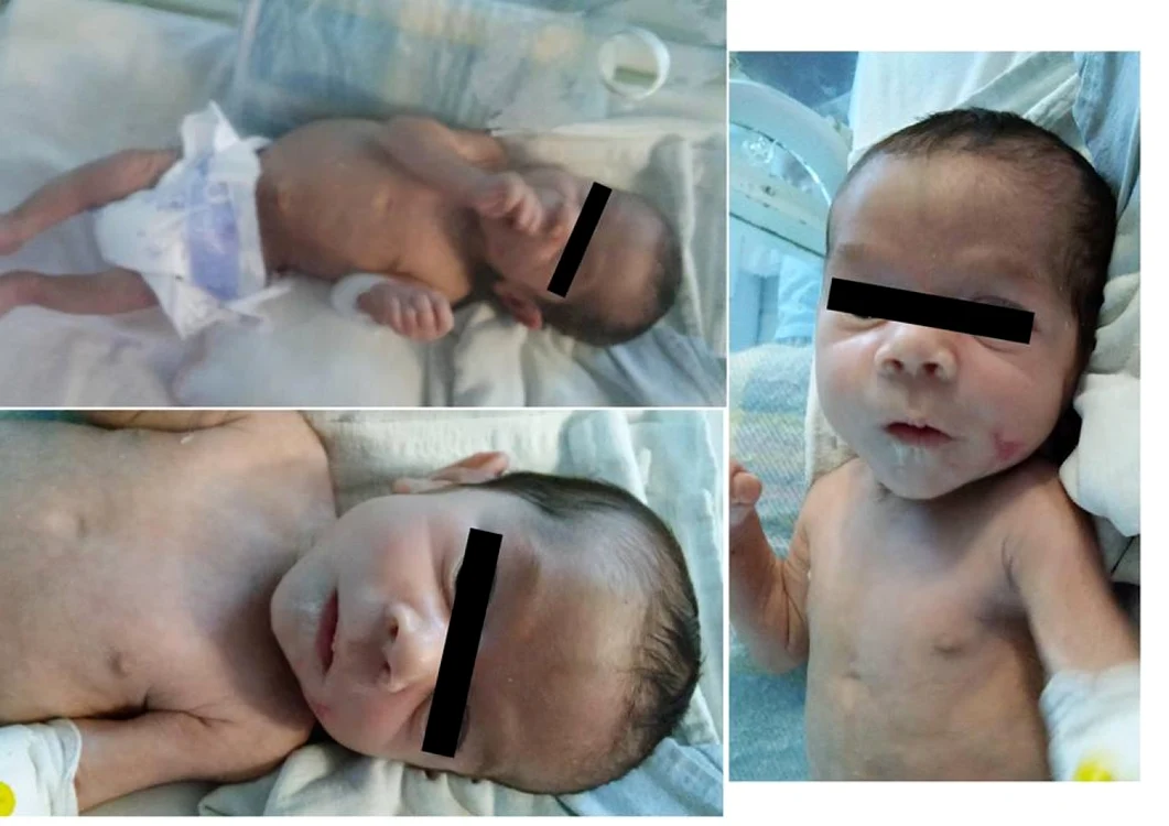 Copilul salvat de medici.                        FOTO: Facebook Spitalul Judeţean Constanţa