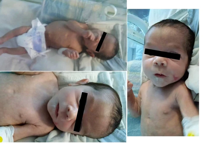 Copilul salvat de medici.                        FOTO: Facebook Spitalul Judeţean Constanţa