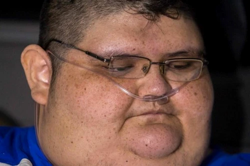 Juan Pedro, cel mai gras om din lume, vrea să aibă o viaţă normală FOTO mirror.co.uk