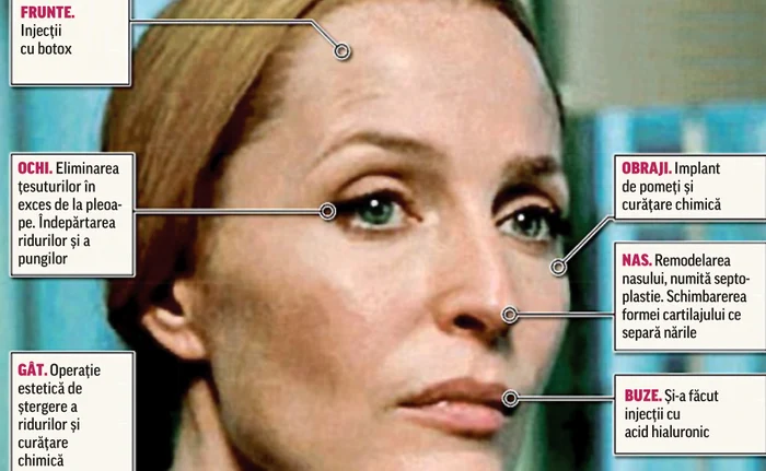 
    Gillian Anderson, eroina din «Dosarele X», a apelat la  operaţii estetice să se menţină tânără  