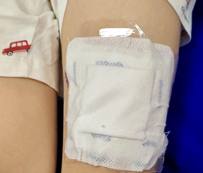 Copil de 6 ani din Botoșani, găsit în stare gravă după ce sora lui i-a aplicat plasturi cu fentanyl