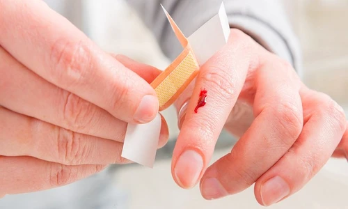 1 81662 original jpg jpeg