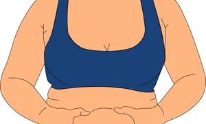 1 grasime abdominala jpg jpeg