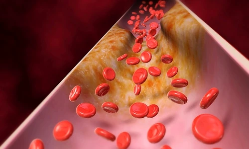 1 65773 original jpg jpeg