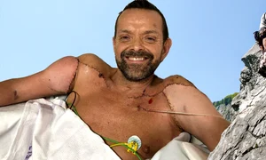 banner transplant mâini 2 2 png