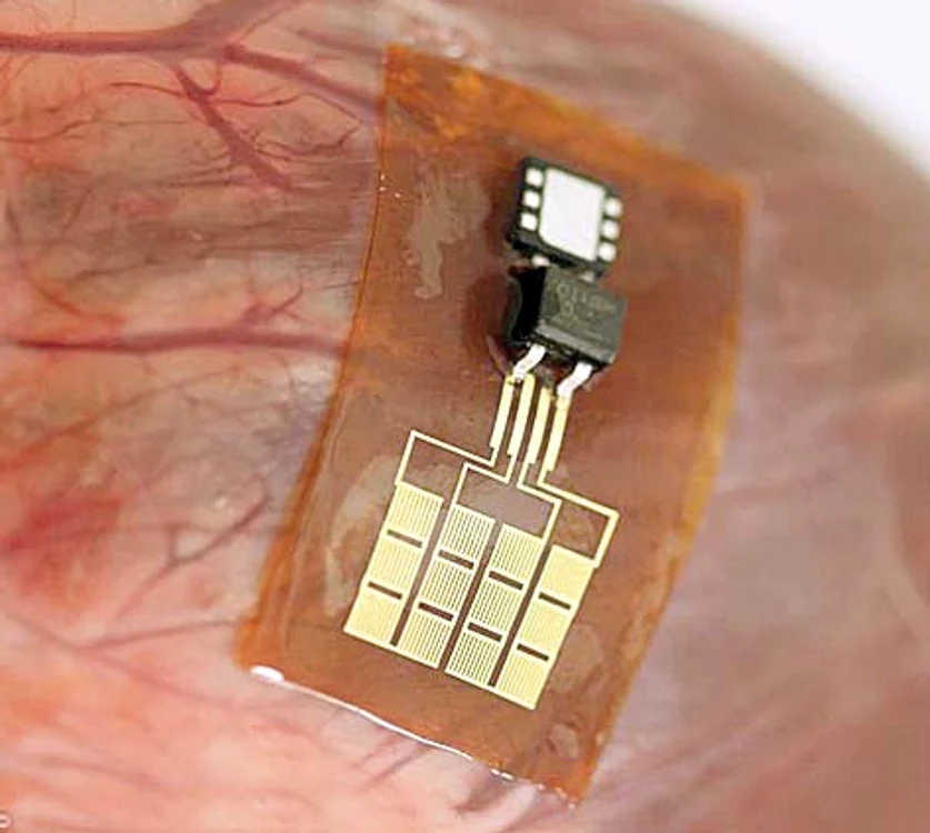 Dispozitivul  funcţionează ca  un stimulator  cardiac