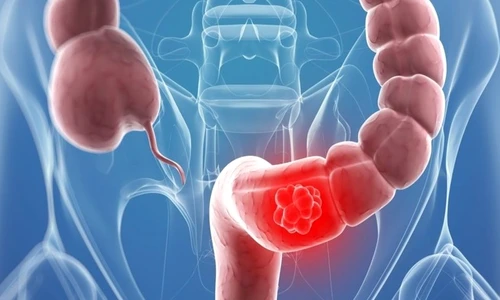 1 70843 original jpg jpeg