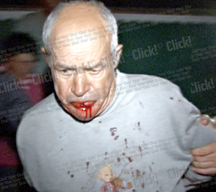 
    După crimă, Constantin  Bâtă a băut acid ca să-şi  pună capăt zilelor  