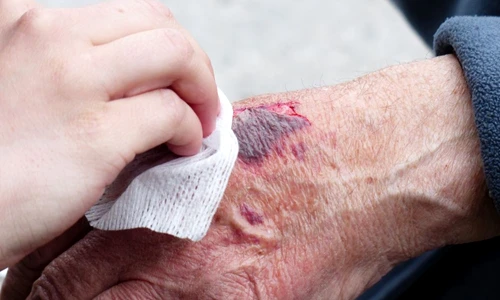 1 70018 original jpg jpeg