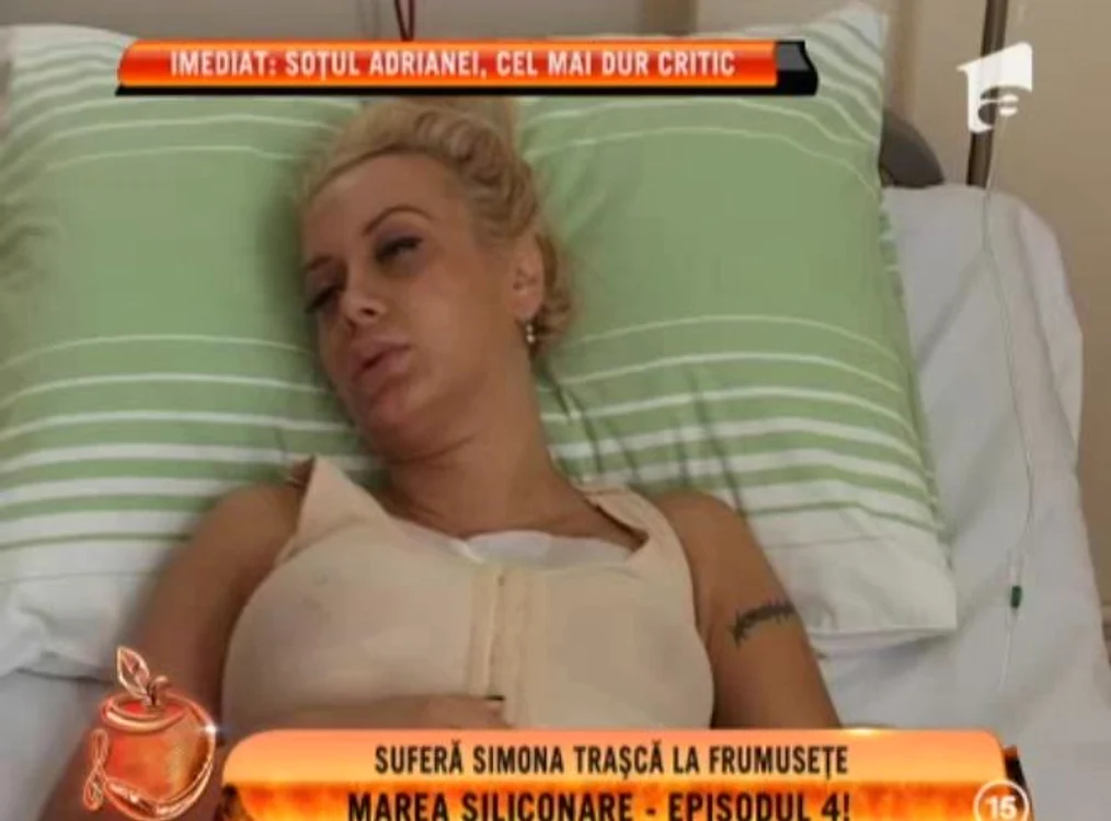 Simona Traşcă s-a operat din nou la sâni