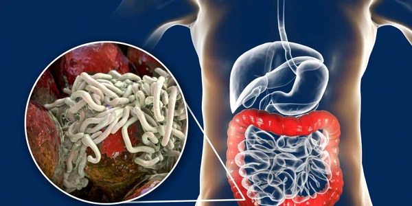 paraziti intestinali jpg