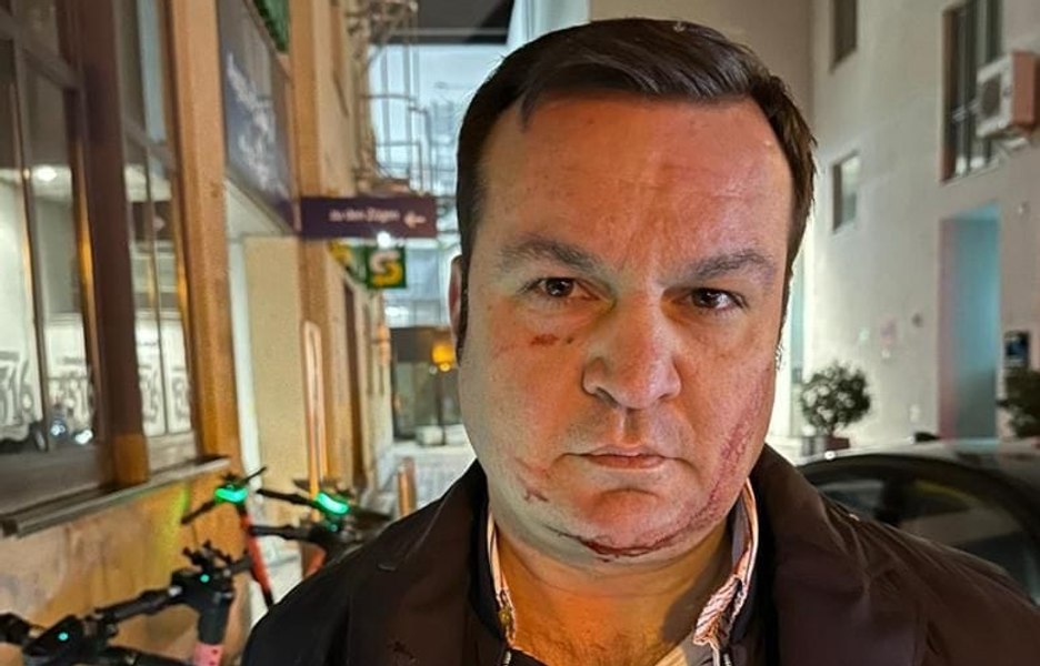 Cherecheș neagă că ar fi opus rezistență la încătușare. Cum s-a ales cu rănile de pe față