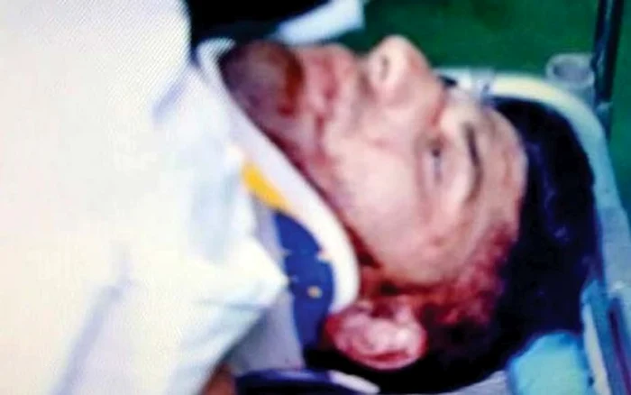 Tânărul de 23 de ani a suferit multiple fracturi