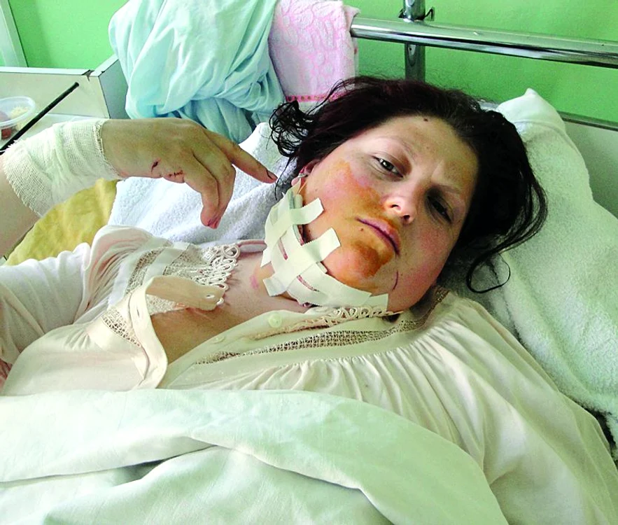 
    Teodora Adriana  arată tăietura de la gât făcută de soţul ei  